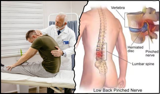 Diagnosis of Lower Back Pain: (पीठ के निचले हिस्से में दर्द का निदान) 1 Diagnosis of lower back pain in hindi