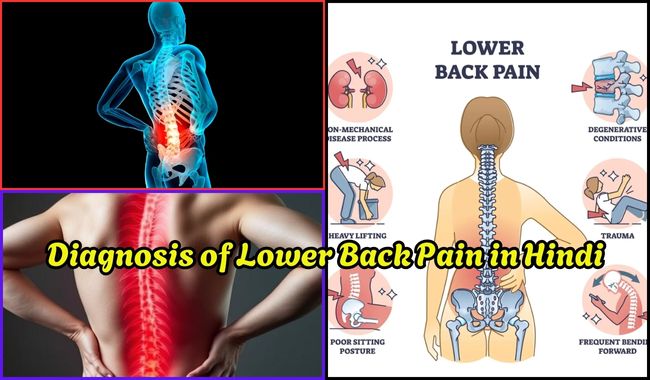 Diagnosis of lower back pain